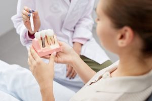 implant-dentaire-a-terrebonne-clinique-dentaire-melanie-poitras
