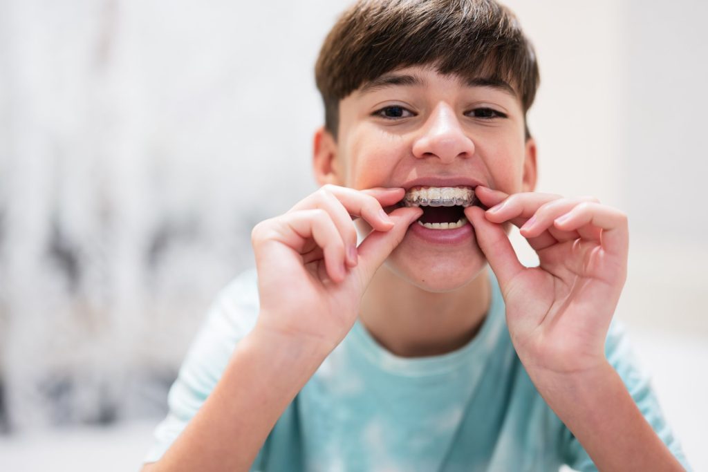 Orthodontie pour enfants (3) - Clinique dentaire Melanie Poitras a Terrebonne