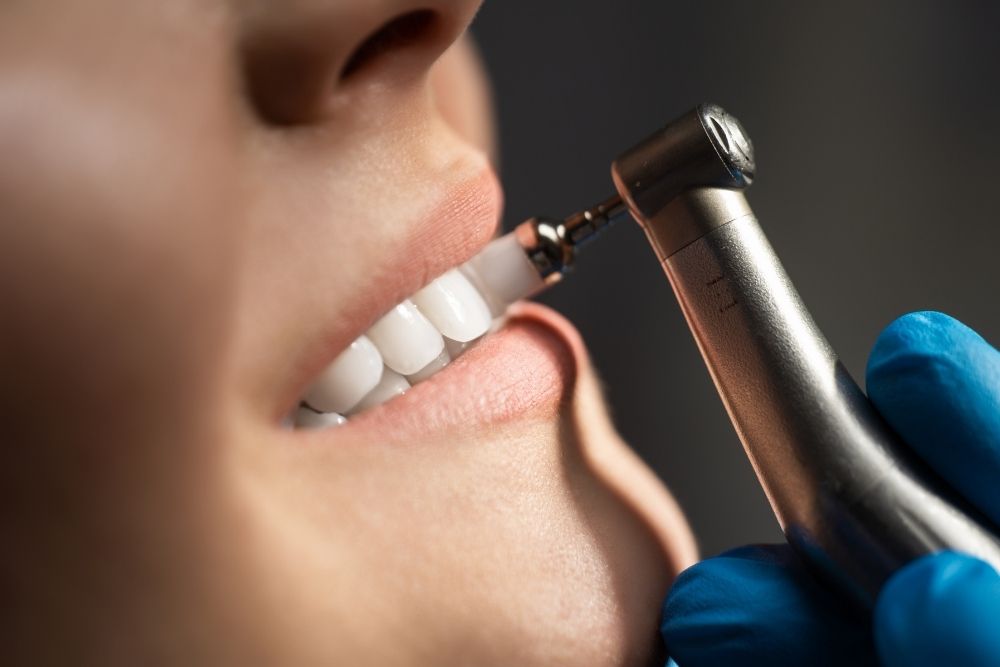 vos nettoyages dentaires Clinique dentaire Melanie Poitras - Dentiste Terrebonne