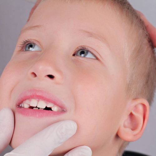 Orthodontie pour enfants (5) - Clinique dentaire Melanie Poitras a Terrebonne